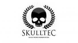 Scalp Micro Pigmentation by Skulltec